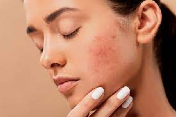 Unveiling the Hidden Dangers: Understanding Skin Damage Caused by Makeup