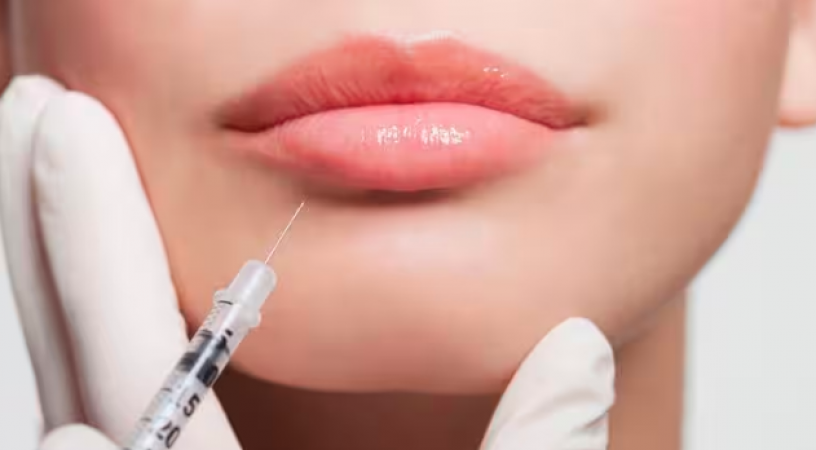 Before taking lip treatment, know the important things related to lip jobs and lip surgery