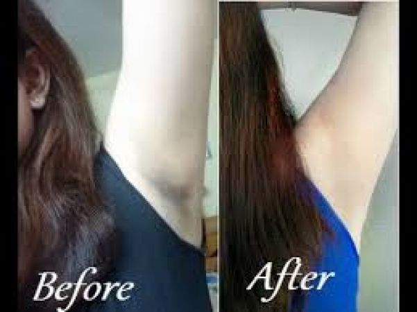 Tips to get clean and clear underarms
