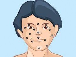 Is there really a connection between a mole on your face and your personality? Know here