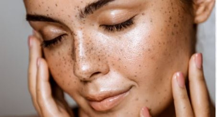 Do this in your lifestyle for clean and flawless skin