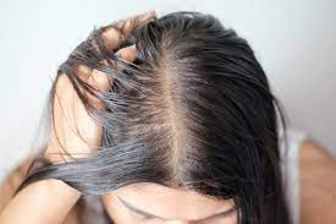 If you are troubled by oily hair then try this remedy, you will get immediate relief from it
