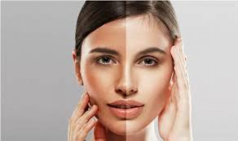 Somewhere the face looks dark and somewhere fair, these tips will improve the skin texture
