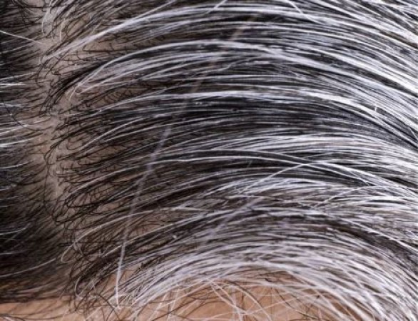 White Hair: With the help of these 3 things, white hair will turn black, you will look younger than before