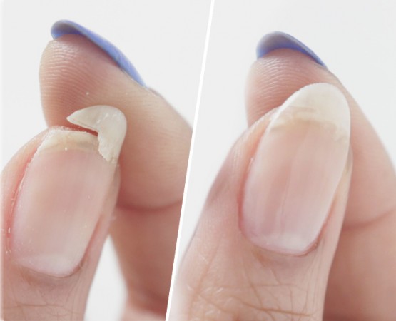 Fix broken nails in these ways