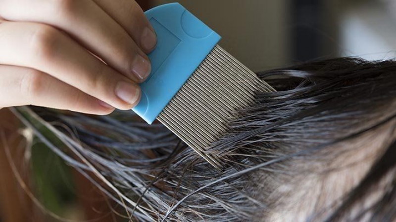 You are troubled by having lice in your hair, follow 6 home remedies to remove them, you will get relief in a few days