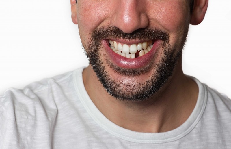 The Top 7 Veg Foods to Eat After Wisdom Tooth Removal