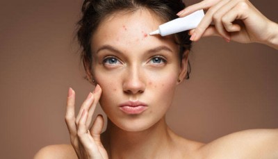 Food to Avoid For Anti Acne Skin