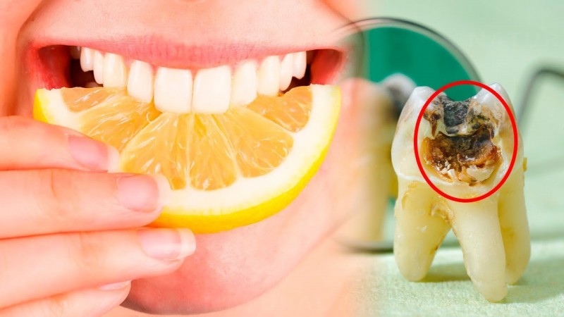 The worst food for your teeth
