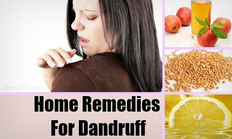7 Home remedies and fantastic food that can control your dandruff naturally
