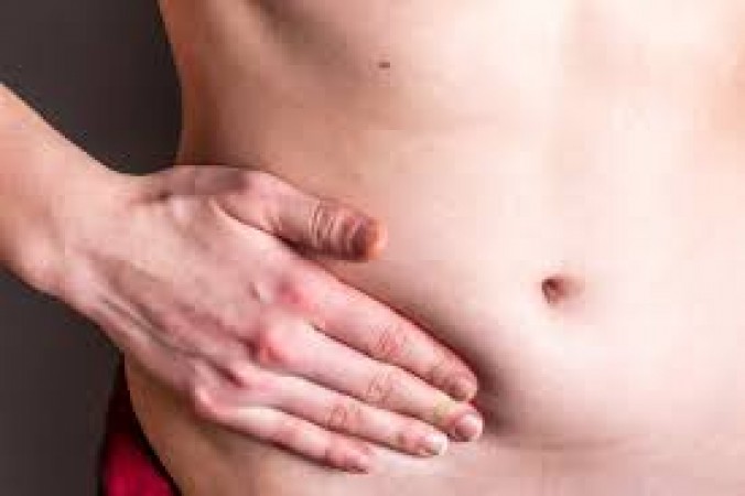 Know what is hernia, identify its causes, symptoms in time, this is the treatment