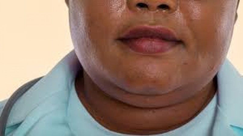 Do you also feel ashamed because of double chin? So start doing this special exercise