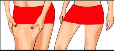 By following these simple tips you can reduce your calves fat….