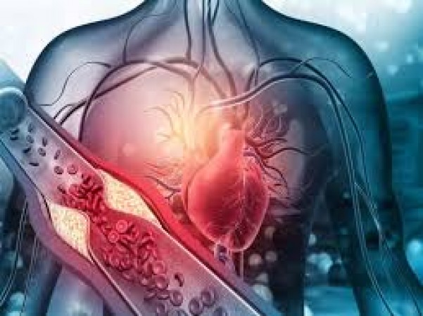 Increasing cholesterol in the body is risky, it causes harm from heart to brain, know the dangers