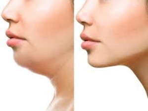 Adopt these exercises to reduce neck fat, effect will be visible in 2 days