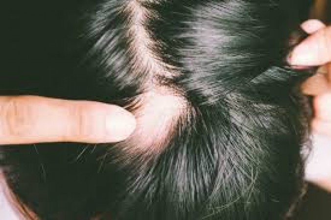 Try this leaf for two weeks, hair will start growing on your bald head