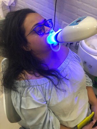 “You’re teeth aren’t pearly, until you smile”- Cosmetic dental surgeon Dr Kshama Chandan bares it all about teeth whitening!