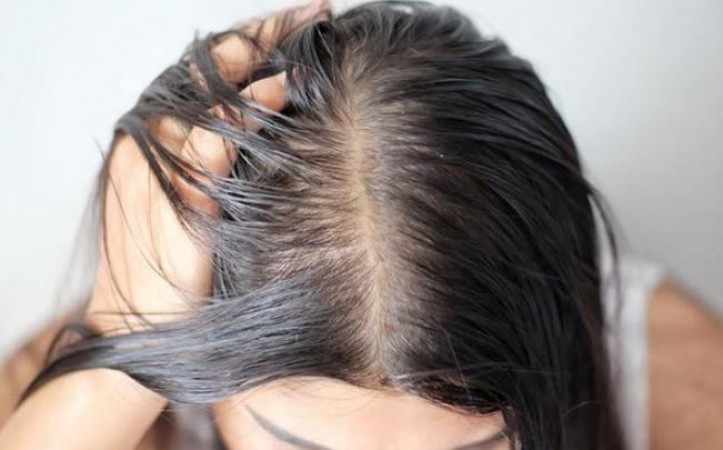 How to Get Rid of Sticky and Oily Hair Due to Sweat