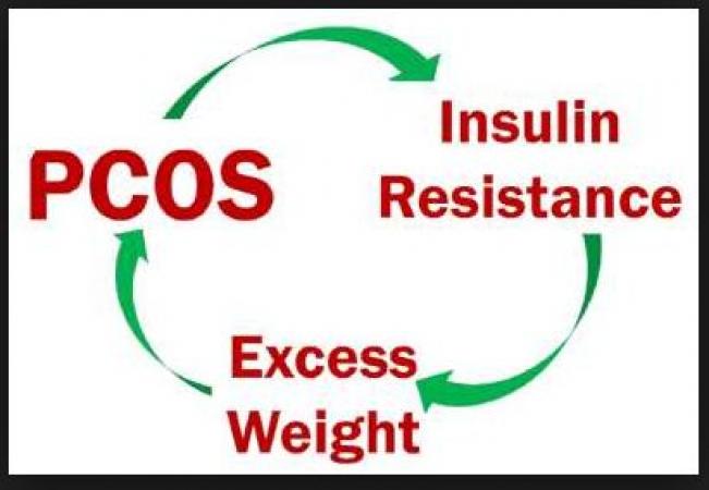 PCOS and Weight Management is a common growing problem among young girls; care this way