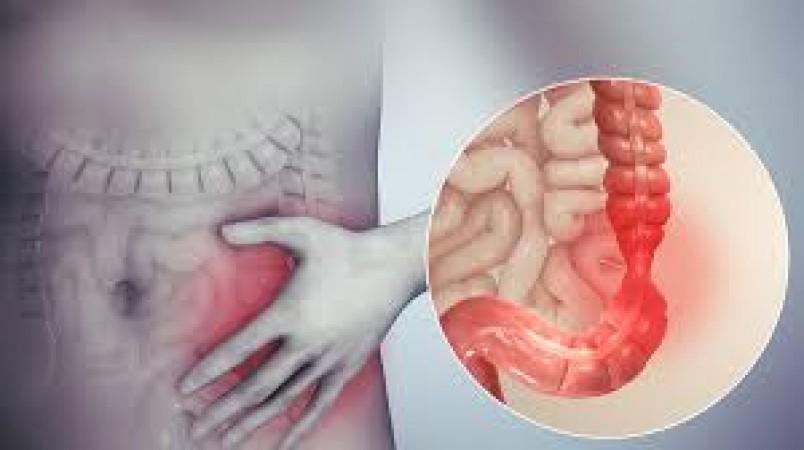 क्या आपका पेट खराब है? यह चिड़चिड़ा आंत्र सिंड्रोम रोग