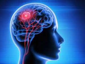 Understanding Brain Tumors: Causes, Symptoms, and Treatment Options