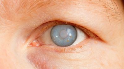 Scientists finally discover causes of Glaucoma