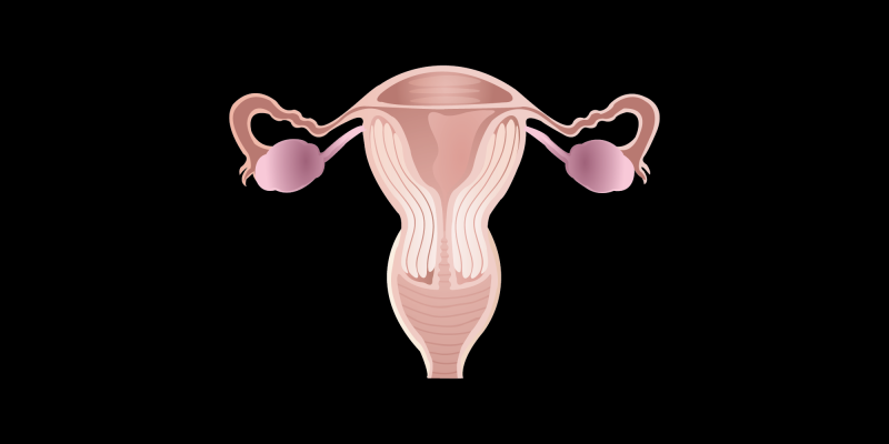 Ovarian Cancer: Understanding, Symptoms, and Prevention