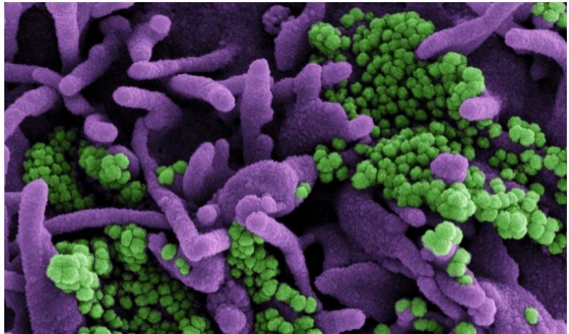 Presence of a Delta-like SARS-CoV-2 mutation exacerbate pandemic's severity