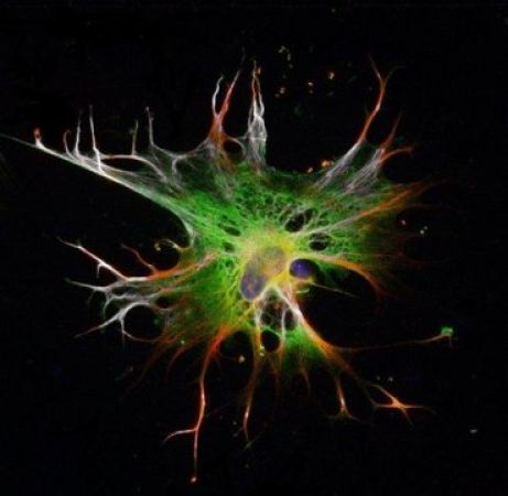 Scientists discover new methods to develop astrocytes from stem cells