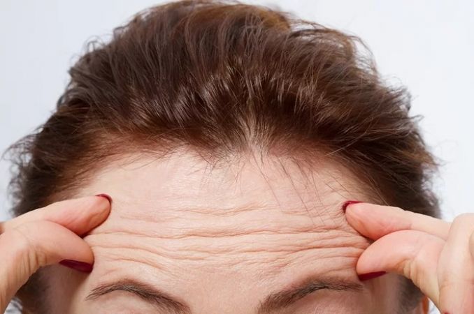 Untimely Forehead wrinkles can be a threat to heart