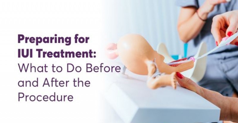 Preparing for IUI Treatment: What to Do Before and After the Procedure