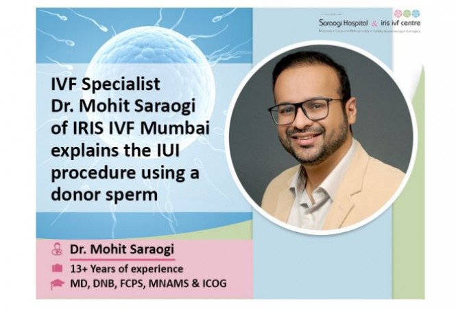 IVF Specialist Dr. Mohit Saraogi of IRIS IVF Mumbai explains the IUI procedure using a donor sperm