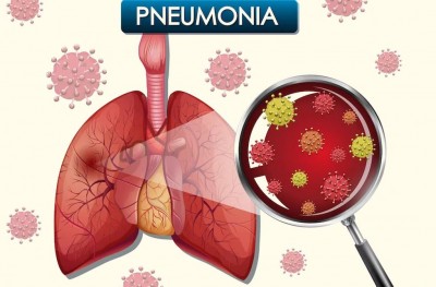 Follow These 2 Tricks to Prevent Pneumonia