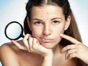 If you are troubled by old spots and blemishes on your face, then apply these five household things mixed together, they will disappear immediately