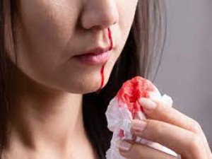 Nose bleeding is a sign of high blood pressure, know about it
