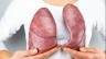 Lung cancer rates on a rise in people who never smoked, know why