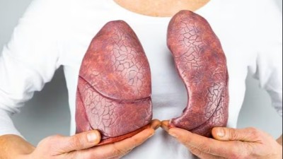 Lung cancer rates on a rise in people who never smoked, know why