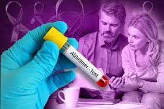 Will you develop Alzheimer's disease and dementia in the next 10 years? You will know through this blood test