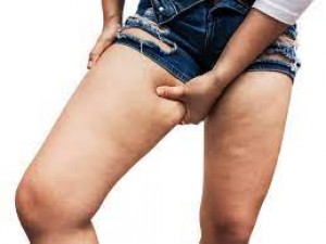Thigh fat is not reducing, remove it with these methods in 1 month