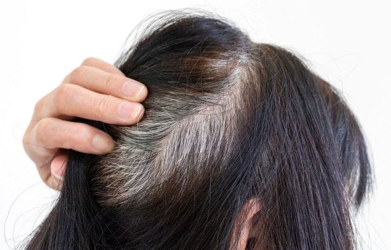 If Your Hair Has Turned Gray at a Young Age, Follow These Tricks for Relief
