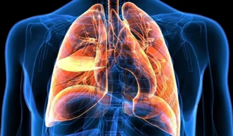 Cystic Fibrosis Treatment: Triple Combination Therapy Shows Remarkable Results
