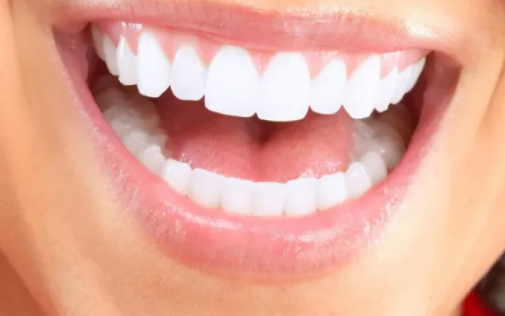 Whiten  your teeth at home naturally