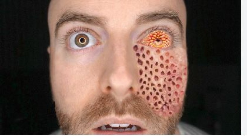 5 Bizarre Diseases That Will Leave You Speechless!