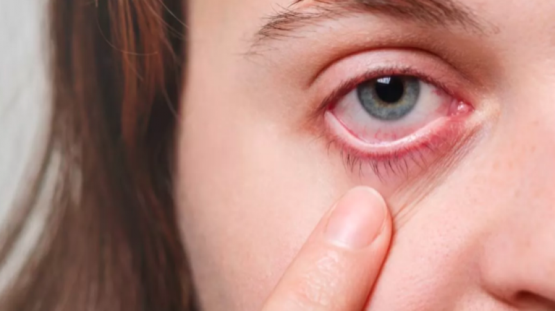 If you work on your laptop for hours, then there may be a problem with dry eye syndrome