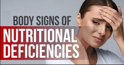 How To Keep Up Nutrient Deficiency in Control: Overcoming a Silent Health Crisis