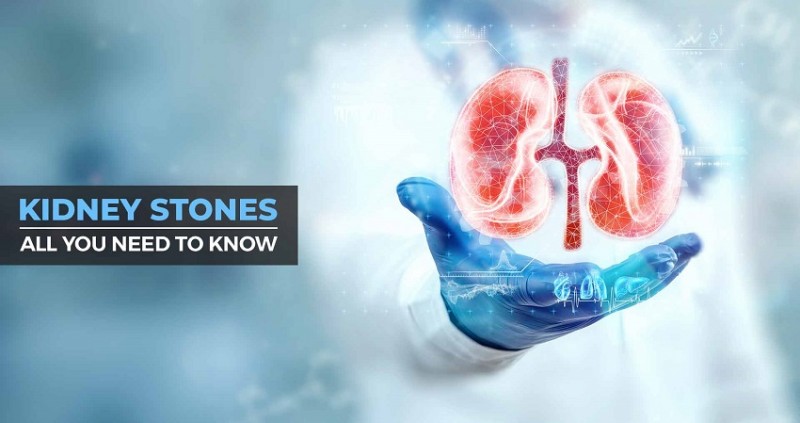 These Essential Tips Can Help You Prevent Kidney Stones, Would You Try Them?