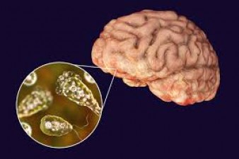What is the 'brain-eating amoeba' Naegleria fowleri? How did it enter the brain of a 5-year-old girl and cause her death