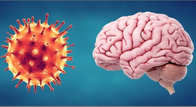 Study shows Covid destructs brain like Parkinson's, Alzheimer's