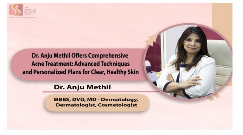 Dr. Anju Methil Offers Comprehensive Acne Treatment: Advanced Techniques and Personalized Plans for Clear, Healthy Skin