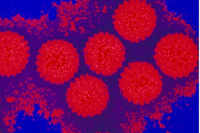 Study finds norovirus, other gut viruses can spread through saliva